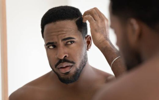 What are the causes of dandruff [iStock]