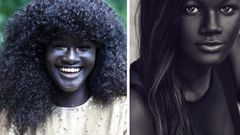 Why do people living near the Equator have darker skin [BoredPanda]