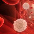 Leukaemia- Cancer Health