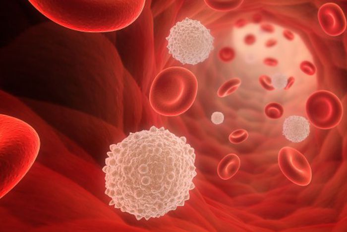 Leukaemia- Cancer Health