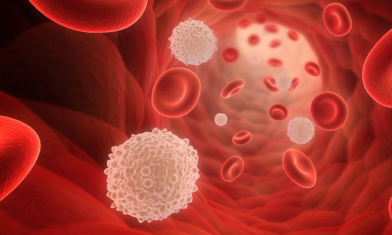 Leukaemia- Cancer Health