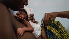 Skin-to-skin contact is known as Kangaroo care [NPR]