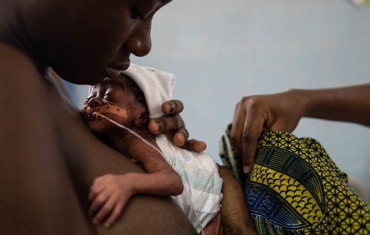 Skin-to-skin contact is known as Kangaroo care [NPR]