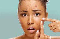 You might experience breakouts [AfricanExtracts]