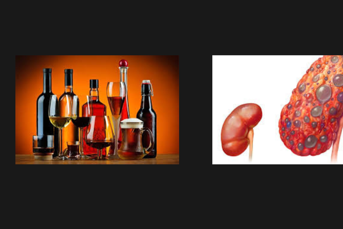 Drinks that damage the kidney [mayoclinic]