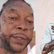 Vybz Kartel opens up on health struggle