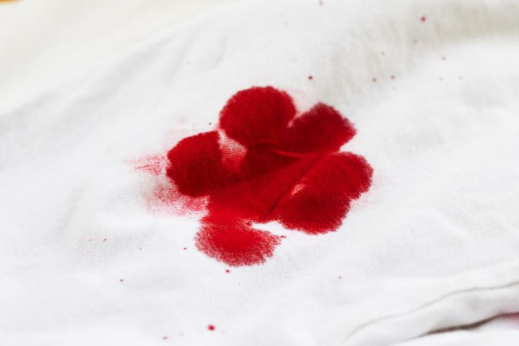 How do you get blood stains off the sheets? [eHow]