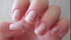 White marks on nails- Marine Healthfoods