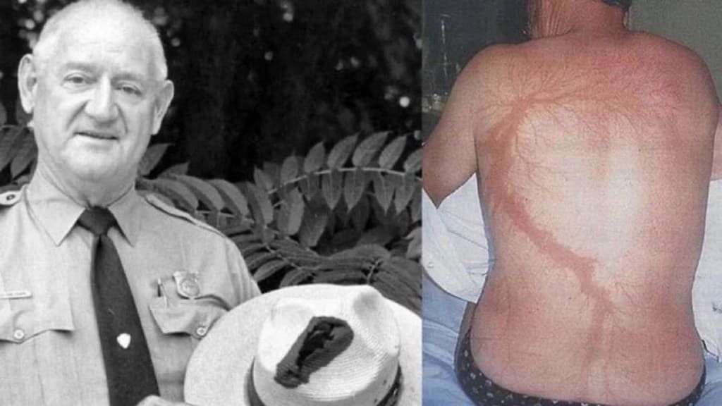 Roy Cleveland Sullivan survived being struck by lightening 7 times [VocalMedia]