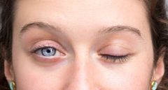 Eye paralysis [AndrePanossian]