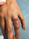 Tight ring-Quora