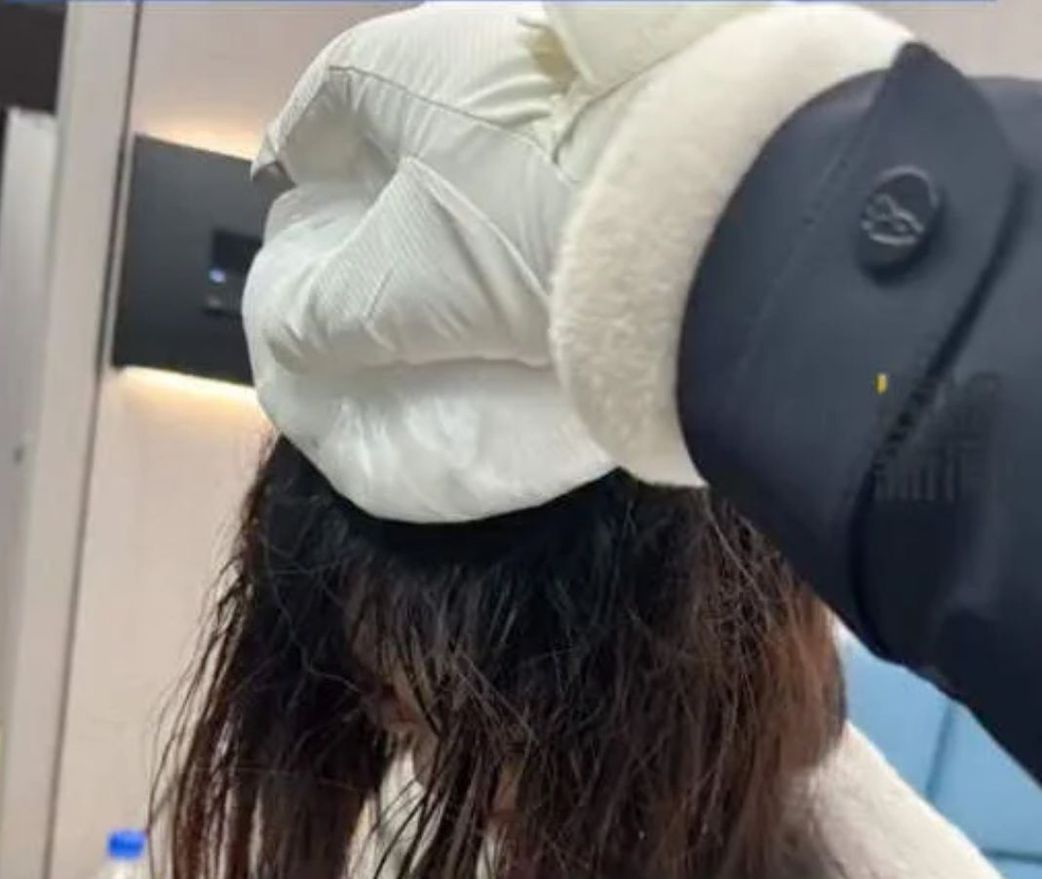 Woman suffers burns while attempting to turn hot water into ice