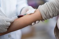 It's crucial to seek medical treatment to prevent progression.