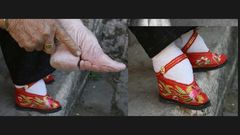 Foot binding in China [openendedsocialstudies]