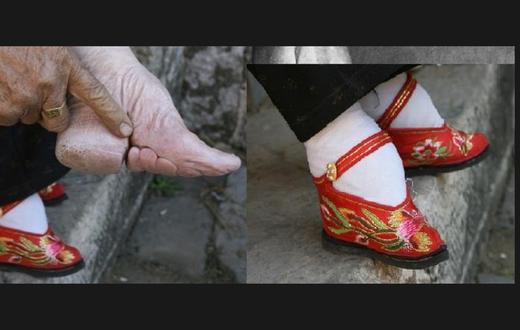 Foot binding in China [openendedsocialstudies]