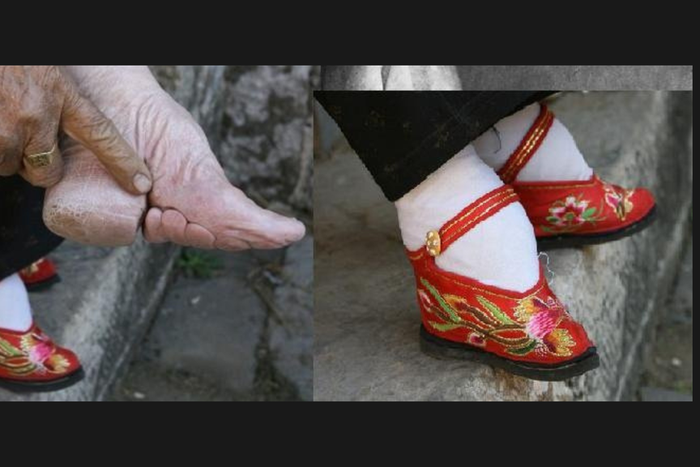 Foot binding in China [openendedsocialstudies]