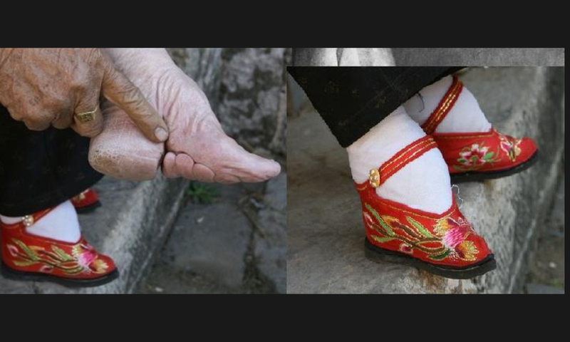 Foot binding in China [openendedsocialstudies]