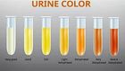 Why does your urine change colour? [Xcom]