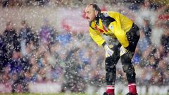 Bruce Grobbelaar