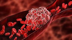 blood-flow