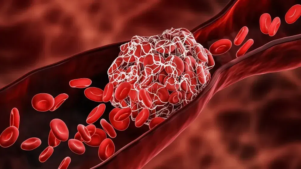 blood-flow