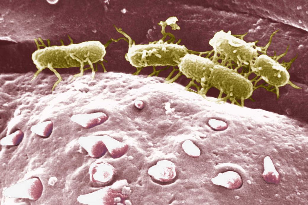 4 stages of typhoid fever: Symptoms and progression explained