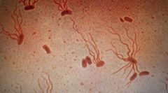 4 stages of typhoid fever: Symptoms and progression explained