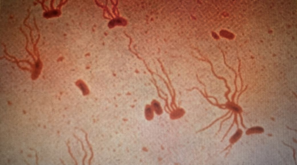 4 stages of typhoid fever: Symptoms and progression explained