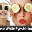 How to get clear white eyes naturally
