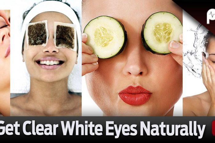 How to get clear white eyes naturally