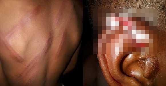 A boy has been left in a pitiable condition after getting bashed by his father. The latter reportedly cut his ear with a blade.