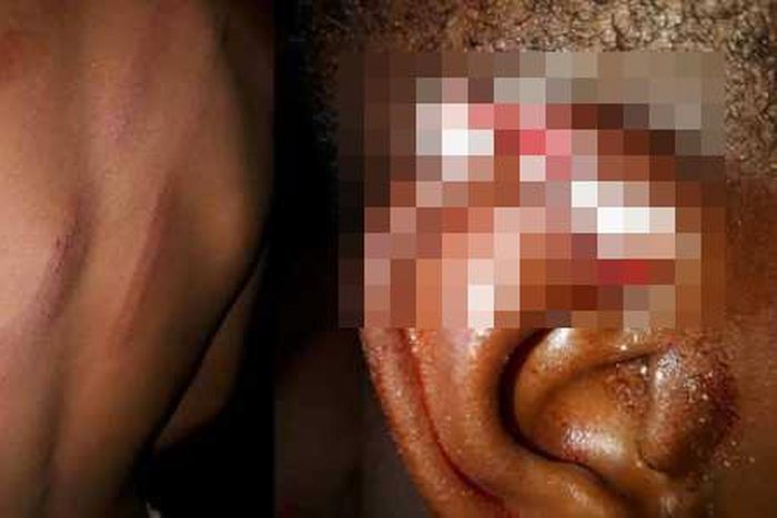 A boy has been left in a pitiable condition after getting bashed by his father. The latter reportedly cut his ear with a blade.