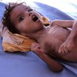 The conflict in Yemen has struggled to garner international attention even as 14 million of its citizens face imminent famine