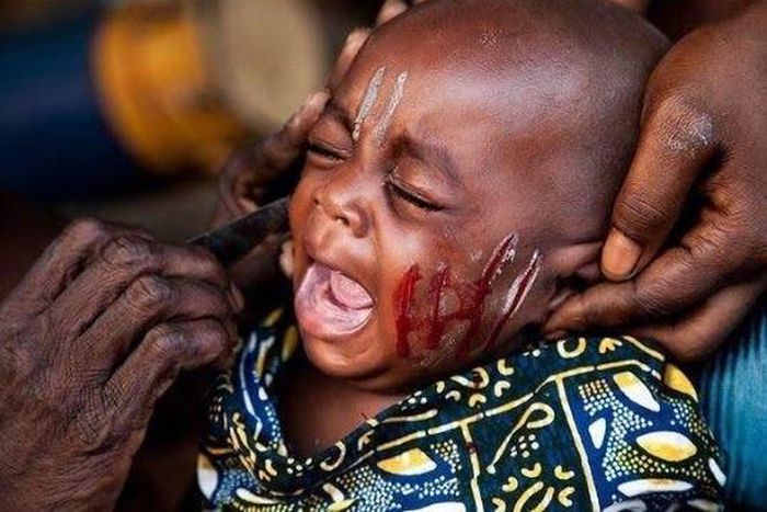 Consent and why tribal marks on children should be outlawed