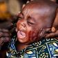 Consent and why tribal marks on children should be outlawed