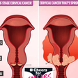 3 ways you can detect cervical cancer early and increase survival rate. [thesun]