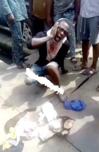 A man deals with the pain that has followed some pummeling by a mob that caught him with stolen underwear.