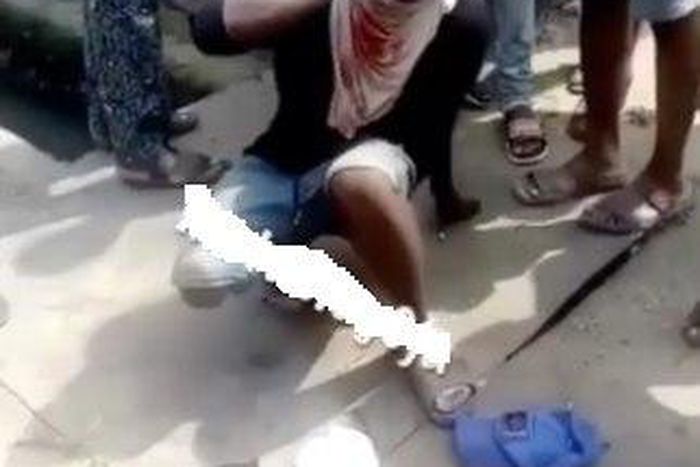 A man deals with the pain that has followed some pummeling by a mob that caught him with stolen underwear.