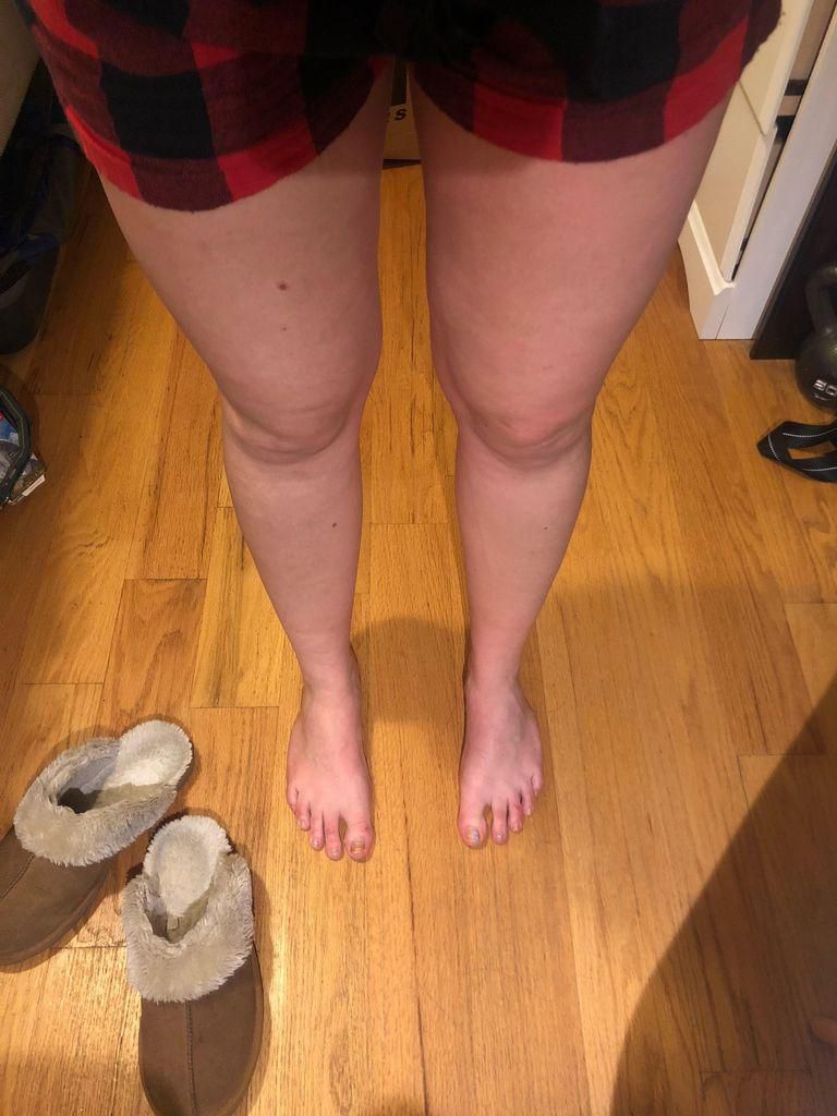 My pasty legs before applying Pradas Glow. (Next beauty treatment: a pedicure.)