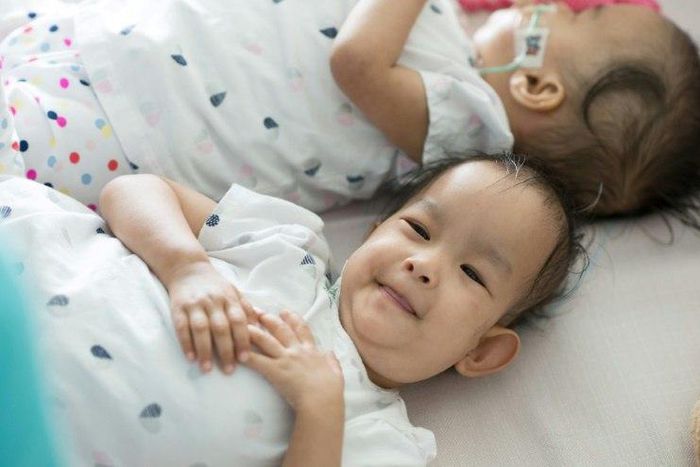 Six days after being separated in a long and complex operation, ex-conjoined twins Nima and Dawa are still not ready to go their own ways