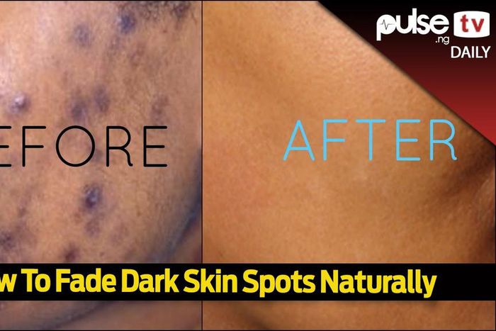 How To Fade Dark Spots Naturally (Pulse)