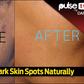 How To Fade Dark Spots Naturally (Pulse)