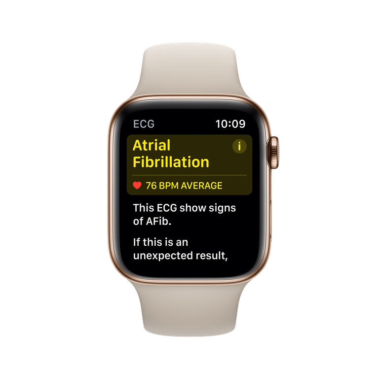 ___9175329___2018___12___6___21___apple-watch-afib-screen-1543960391