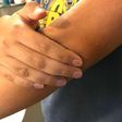 Here's how to get rid of dark elbows naturally. [sandandorsnow]