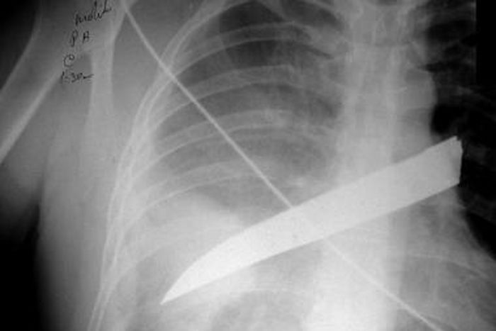 A man is impatient about his meal so he reportedly stabs his sister who was preparing it at the time. -