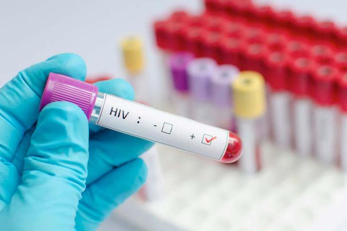 ___8225861___2018___4___9___12___HIV+disease.+-+The+Guardian+Nigeria