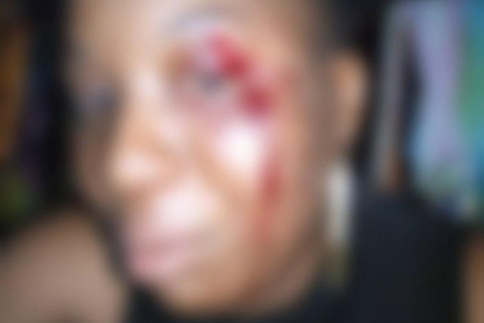 A woman feels mistreated after receiving a damaging punch from a Nigerian soldier who was reportedly drunk at the time of their meeting.