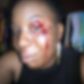A woman feels mistreated after receiving a damaging punch from a Nigerian soldier who was reportedly drunk at the time of their meeting.