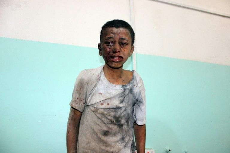 A Yemeni boy at a hospital after he was wounded in an air strike in Saada province on August 9, 2018, which killed 40 children