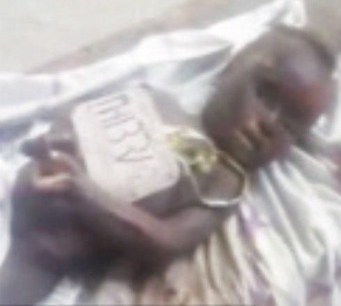 An image shows the mutilated body of a baby who died of anaemia.